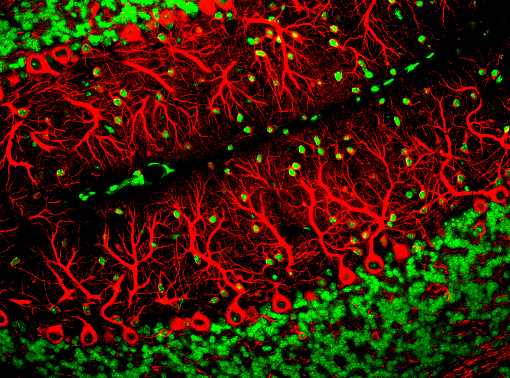 Credit: Yinghua Ma and Timothy Vartanian, Cornell University, Ithaca, N.Y.