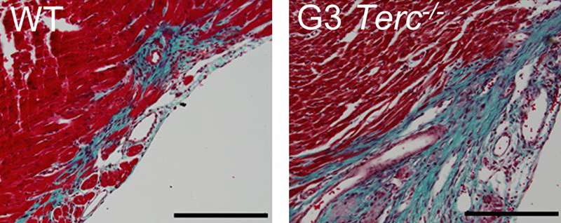 Telomerase deficient tissue (right) displays poor regenerative capacity just 1 day after birth, producing larger fibrotic deposition following damage (blue). Credit: Aix et al., 2016