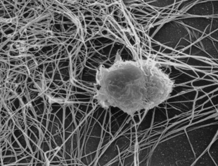 A dendritic cell 