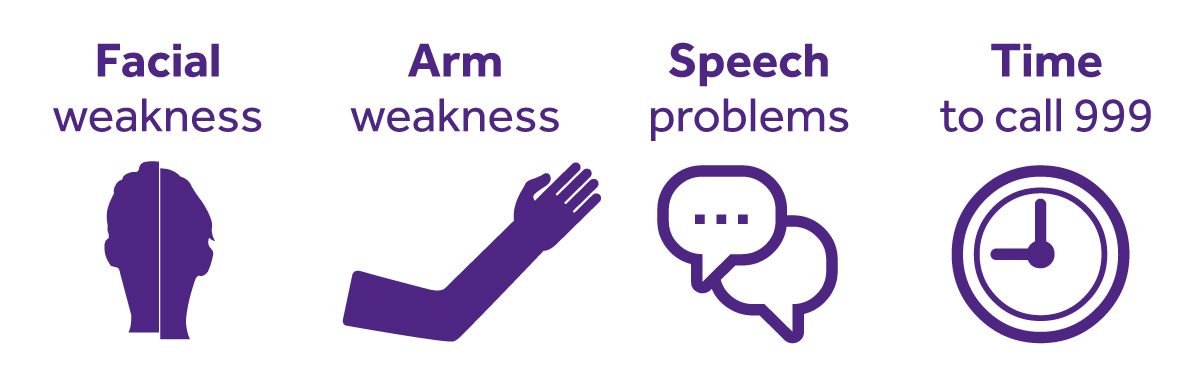 The FAST test for recognising a stroke event Credit: stroke.org.uk