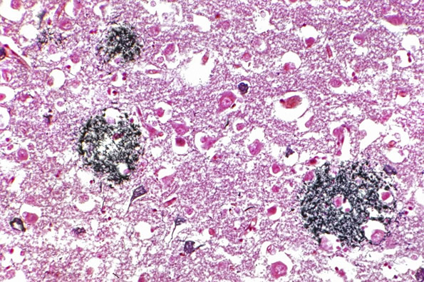 Credit: Spike Walker, Wellcome Images