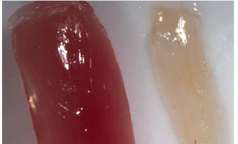 A normal muscle (left) compard to a muscle without β1-integrin. Credit: Chen-Ming Fan and Michelle Rozo