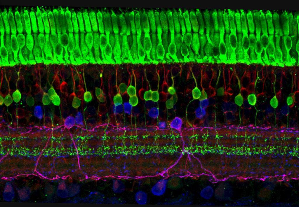 Credit: Wei Li, National Eye Institute, National Institutes of Health. Part of the exhibit Life:Magnified by ASCB and NIGMS