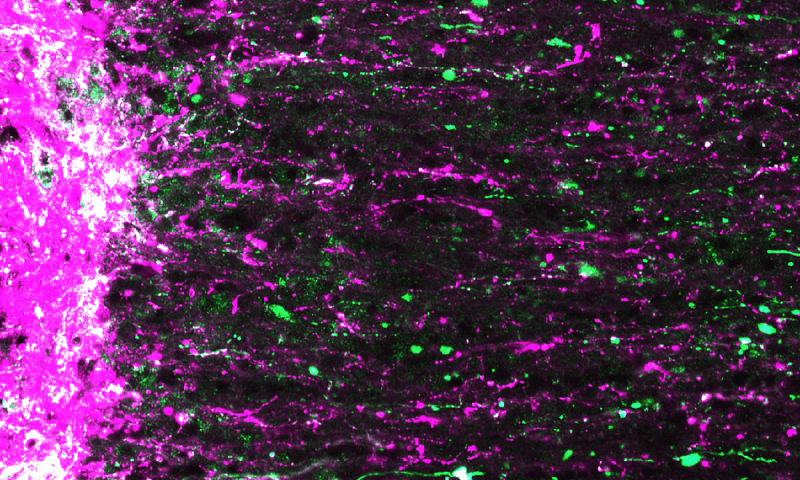 Mouse retinal ganglion cell axons (magenta and green) extending from site of optic nerve injury. Credit: Andrew D. Huberman