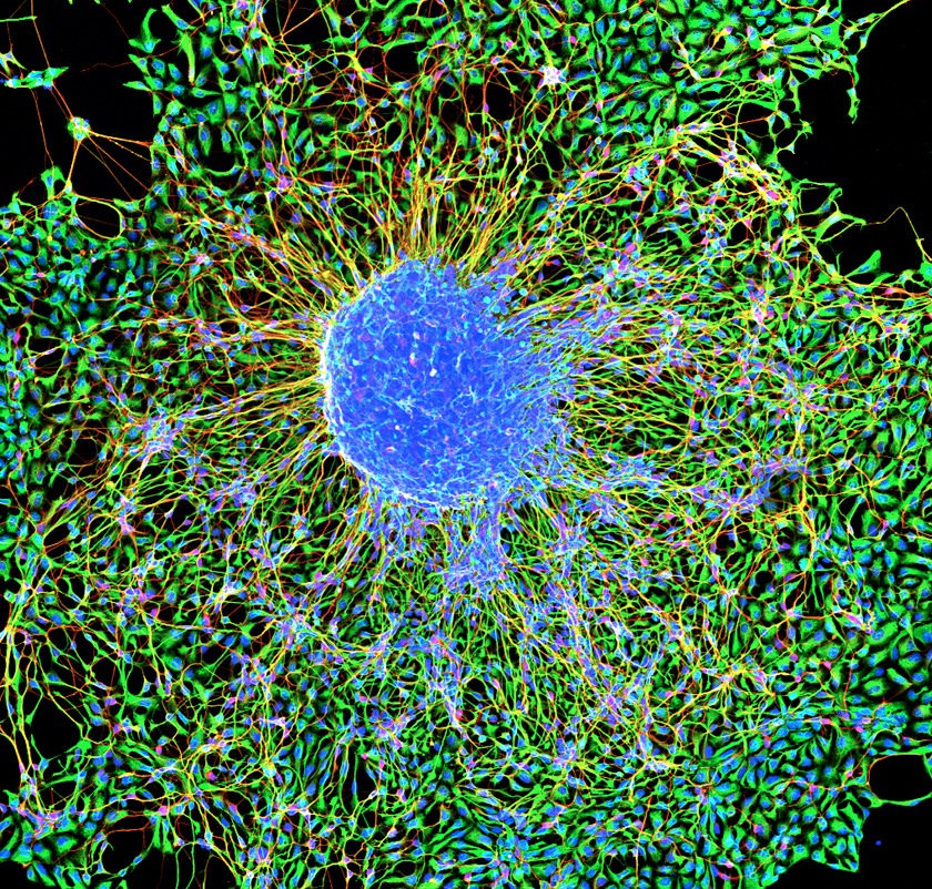 Credit: Scott Vermilyea, NIH Image Gallery
