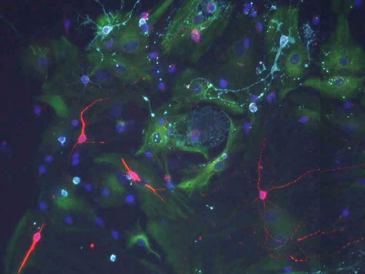Stem cells bathed in signals from a young choroid plexus recover their previous regenerative capacity. Credit: Biozentrum, University of Basel
