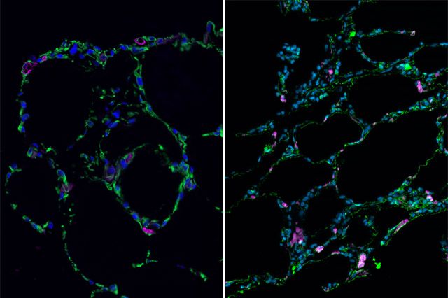The engineered lung tissue can be seen on the left, contrasted with real lung tissue on the right. Credit: UCLA Broad Stem Cell Research Center