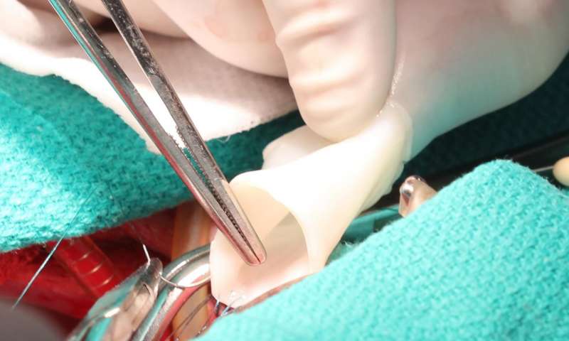 The tissue-engineered graft ready for implantation. Credit: University of Minnesota