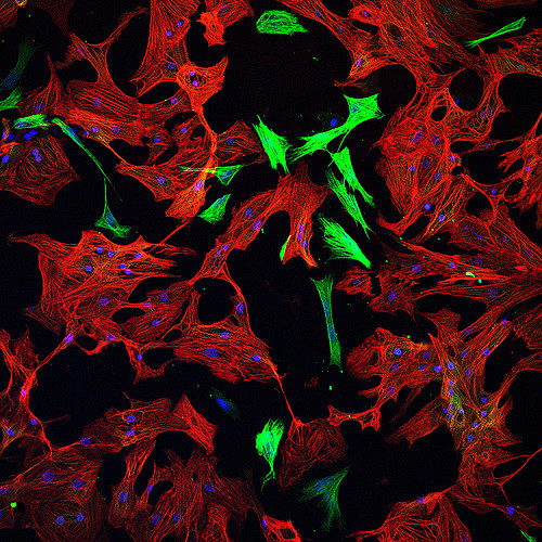 Cardiomyocyte cells. Credit: arboreus/Flickr