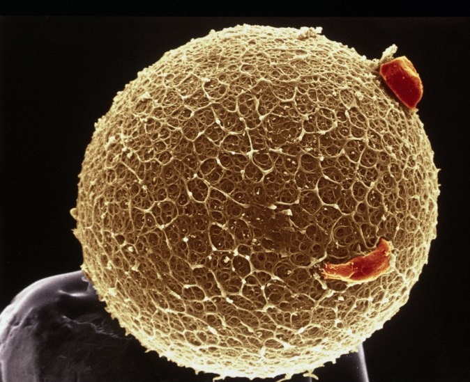 Credit: Wellcome Images