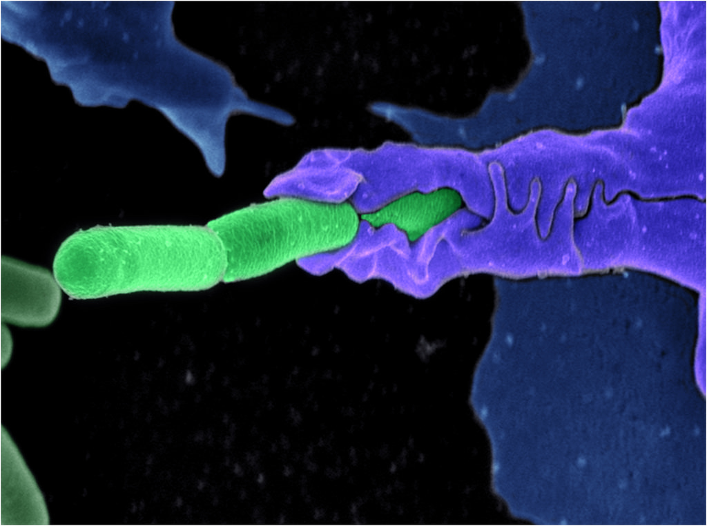 Credit: ZEISS Microscopy