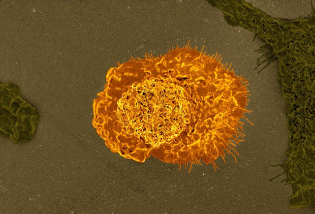 Colorized scanning electron micrograph of a macrophage. Credit: NIAID