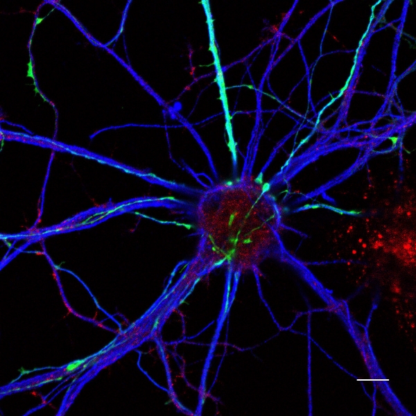 Credit: ZEISS Microscopy