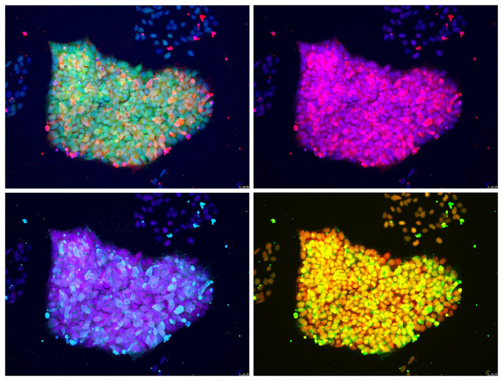  IPSCs. Credit: National Institute of Arthritis
