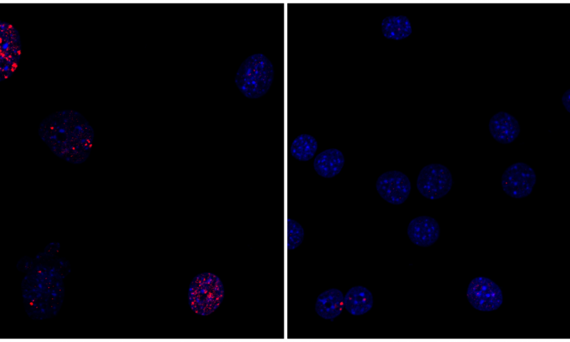 Partial cellular reprogramming reverses cellular signs of aging such as accumulation of DNA damage. (Left) Progeria mouse fibroblast cells; (right) progeria mouse fibroblast cells rejuvenated by partial reprogramming. Credit: Salk Institute