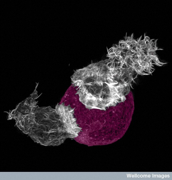 T cells attacking a target. Credit: N. Dieckmann, Griffiths Lab, Cambridge Institute for Medical Research. Wellcome Images