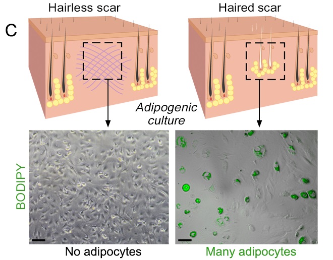 Comparison of wounds healing with and without hair follicles. Credit: Penn Medicine
