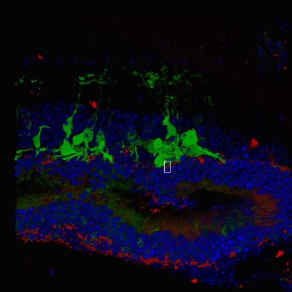 Synaptic integration of graft retina into host mice. Host bipolar cells shown in green and graft retina shown in red. Credit: Mandai et al./Stem Cell Reports 2017