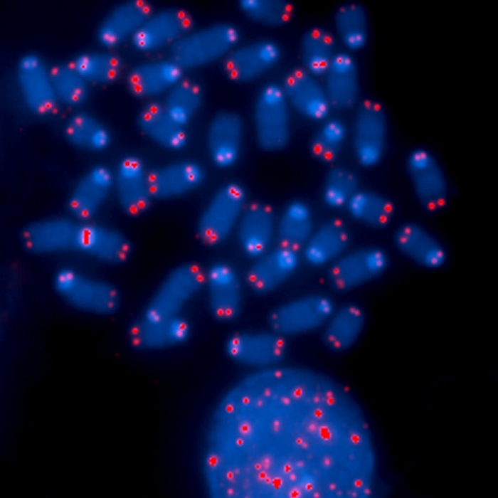 Credit: Thomas Ried, NCI Center for Cancer Research, National Cancer Institute, National Institutes of Health