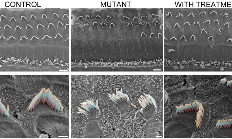 Normal mice sensory hair bundles (bottom left) and mutant mice (middle column). After treatment structure is restored (bottom right). Credit: Gwenaelle Géléoc and Artur Indzkykulian