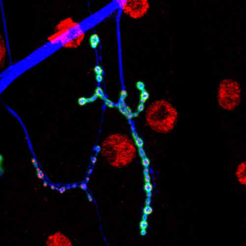 Insect neuromuscular junction. Credit: NICHD NIH