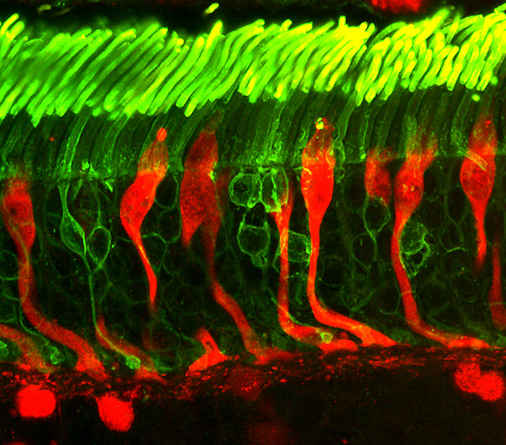 Rods and cones photoreceptors in a human retina. Credit: National Eye Institute