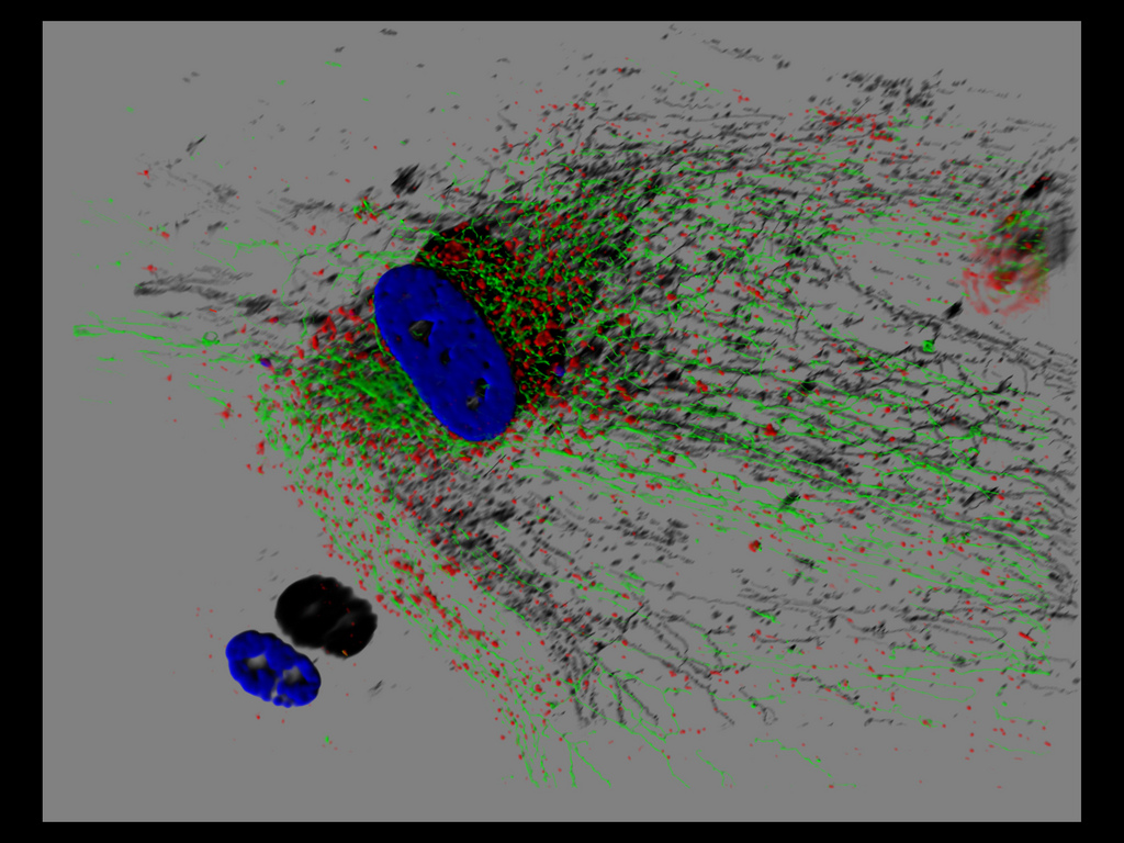 Senescent fibroblast. Credit: Glyn Nelson/Flickr