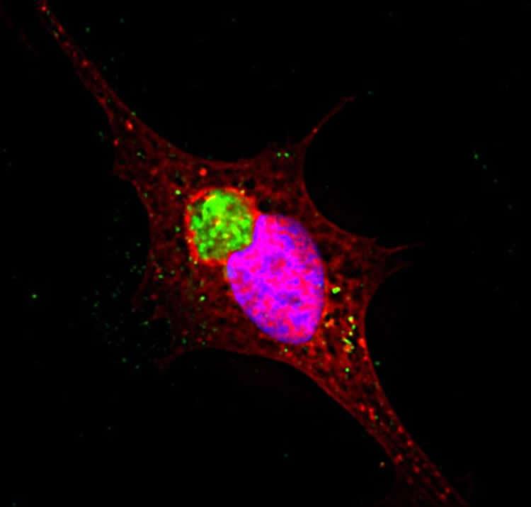 Ruptured vesicles containing alpha-synuclein protein (green) create large clumped structures resembling those seen in Parkinson's disease. Credit: Loyola University Chicago.