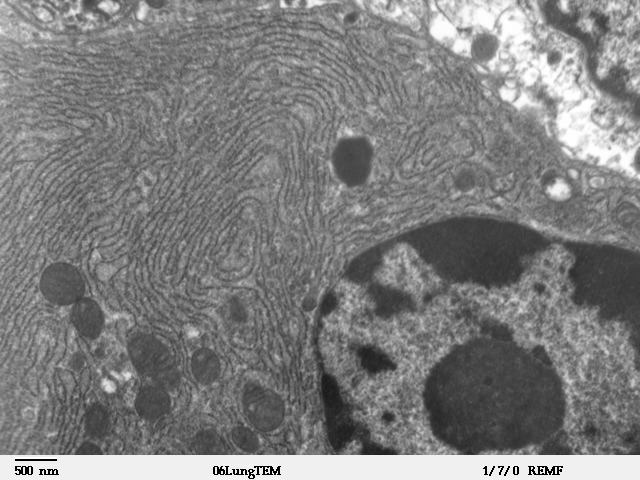 Transmission electron microscope image of a thin section cut through an area of mammalian lung tissue. Credit: Louise Howard/Wikimedia Commons