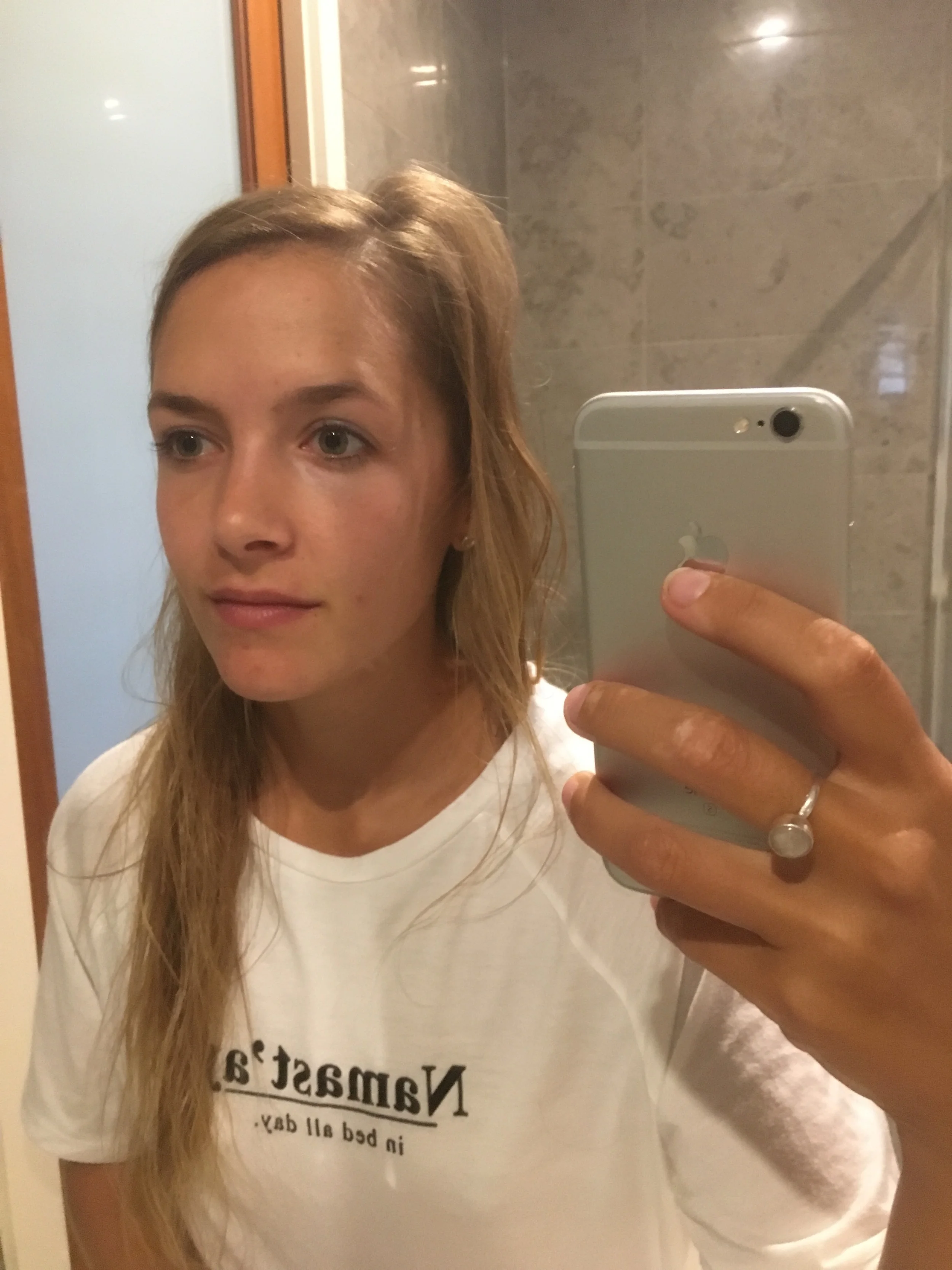 Before... it doesn't look so bad but trust me, it got worse. I have been getting the types of blemishes that look like I have a rash across my whole face. And most of them are able to be squeezed... white heads I'll call them. 