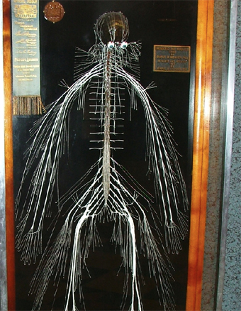 bundle of nerves PA.jpg