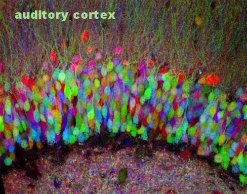 auditorycortex.jpg