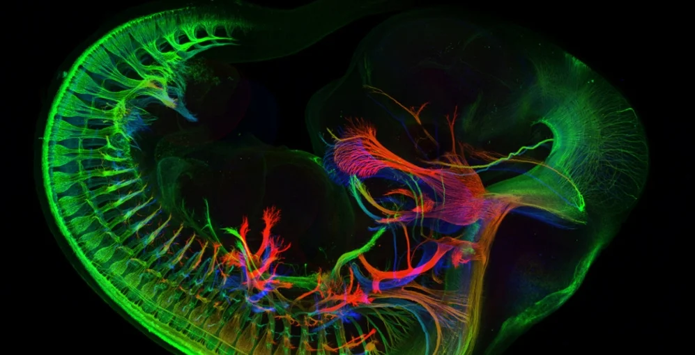 14th-place-winner-an-image-of-peripheral-nerves-in-e11-5-mouse-embryo-by-mr-zhong-hua.jpg