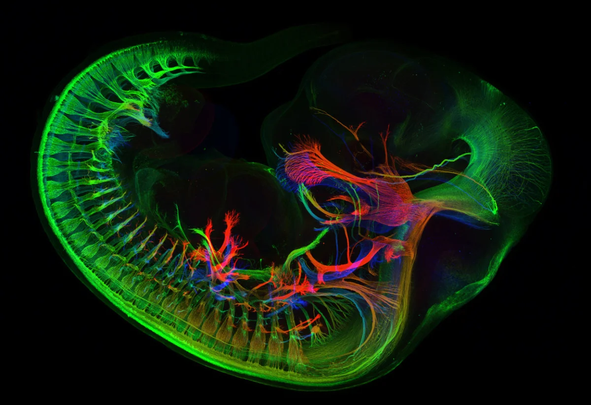 14th-place-winner-an-image-of-peripheral-nerves-in-e11-5-mouse-embryo-by-mr-zhong-hua.jpg
