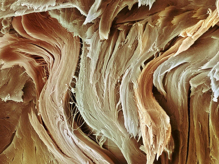 collagen-sem-steve-gschmeissner.jpg