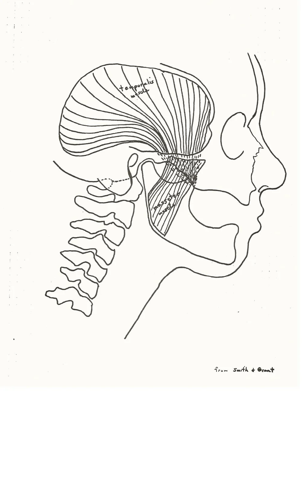 Masseter.jpg