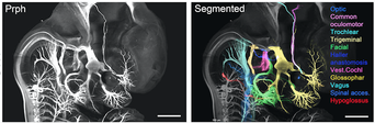 preview-gallery-cranial-nerves-segmented-gw7.png