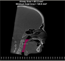 imaging-airway.jpg