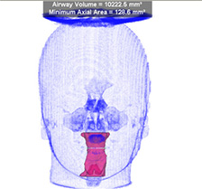 imaging-airway2.jpg