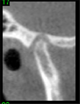 imaging-airway3.jpg