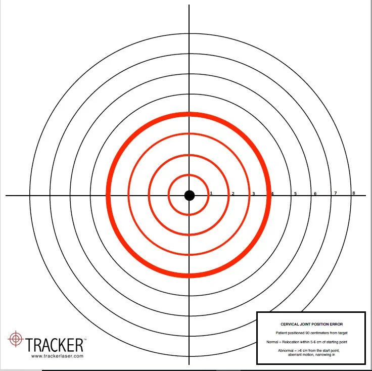 tracker laser