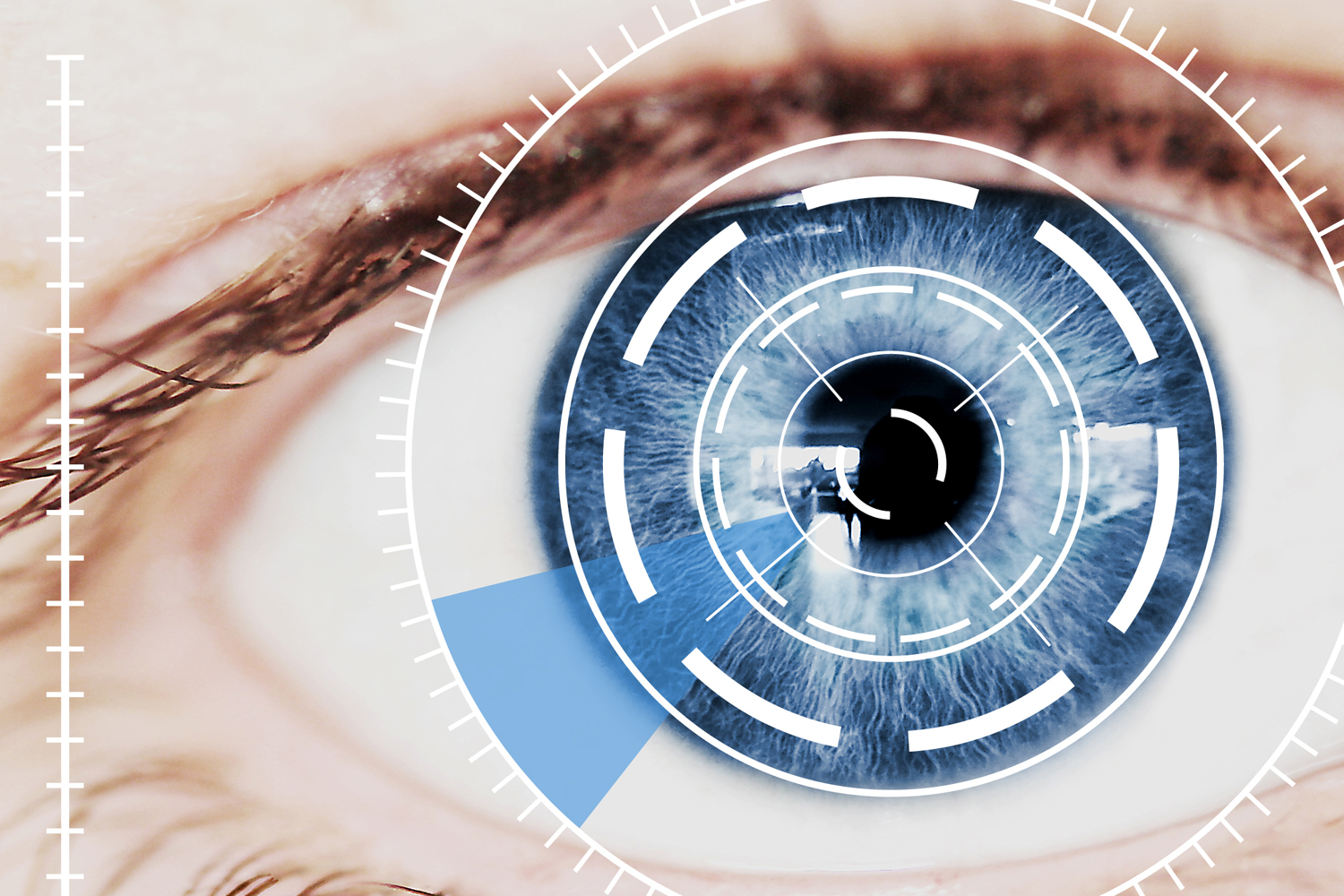 Blue light and macular degeneration — Blue Light Exposed
