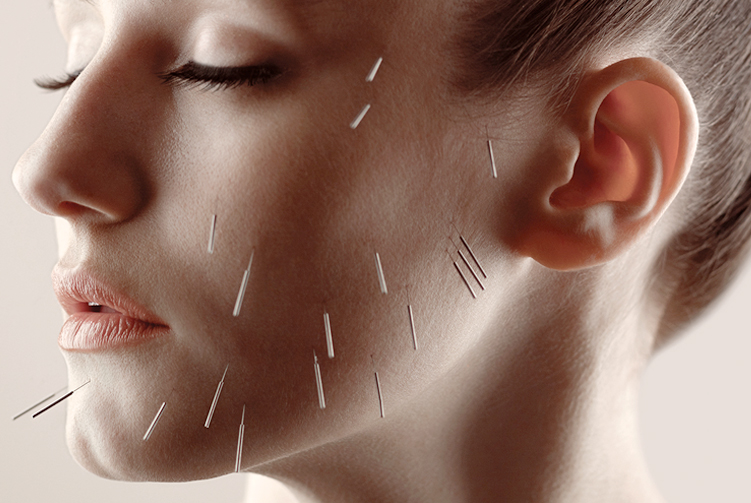 Facial Rejuvenation Acupuncture Points Chart