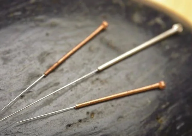 Acupuncture And The Treatment Of Migraines.