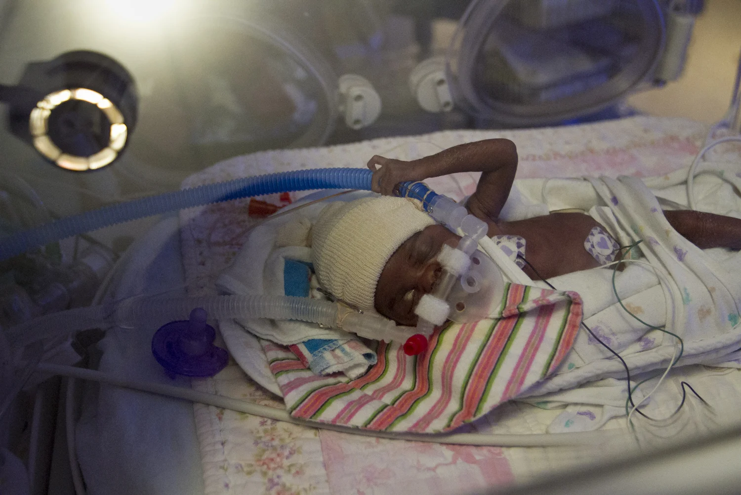 Three-week-old Nasiyah Pierre is monitored in the Neonatal Intensive Care Unit.