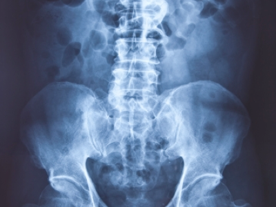 pelvis