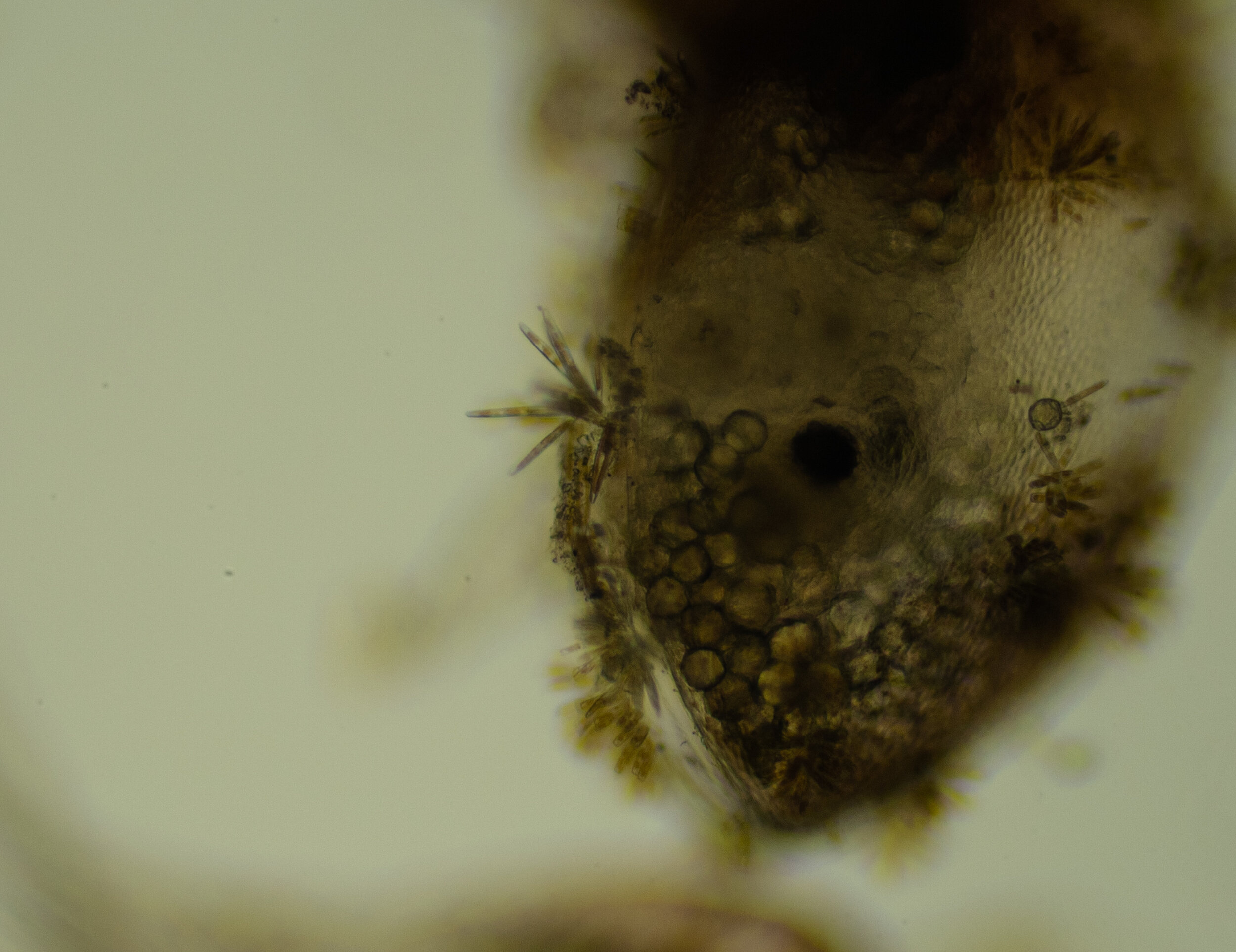Barnacle Cyprid Larvae