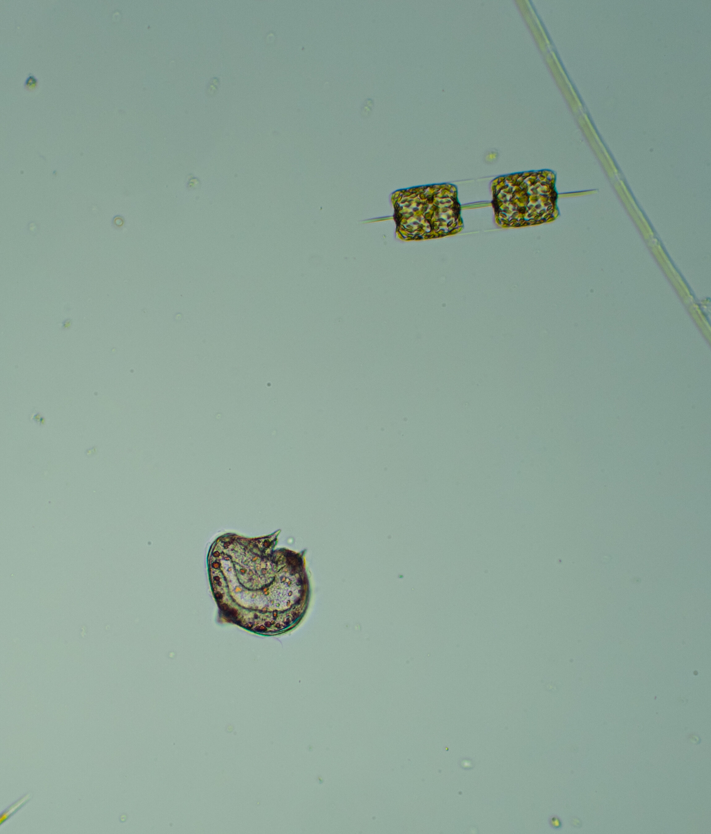 Protoperidinium sp. (lower left)