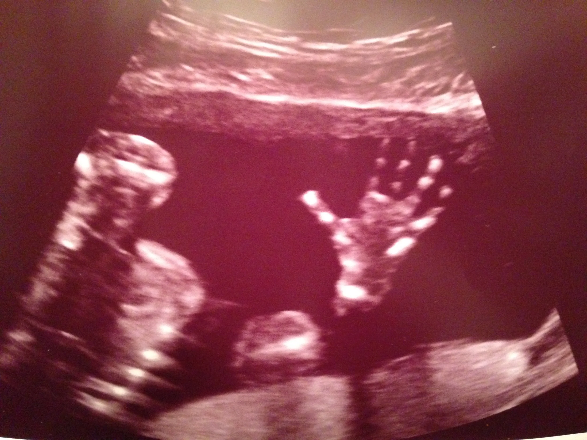 Baby Boy Parker - ETA September 2015