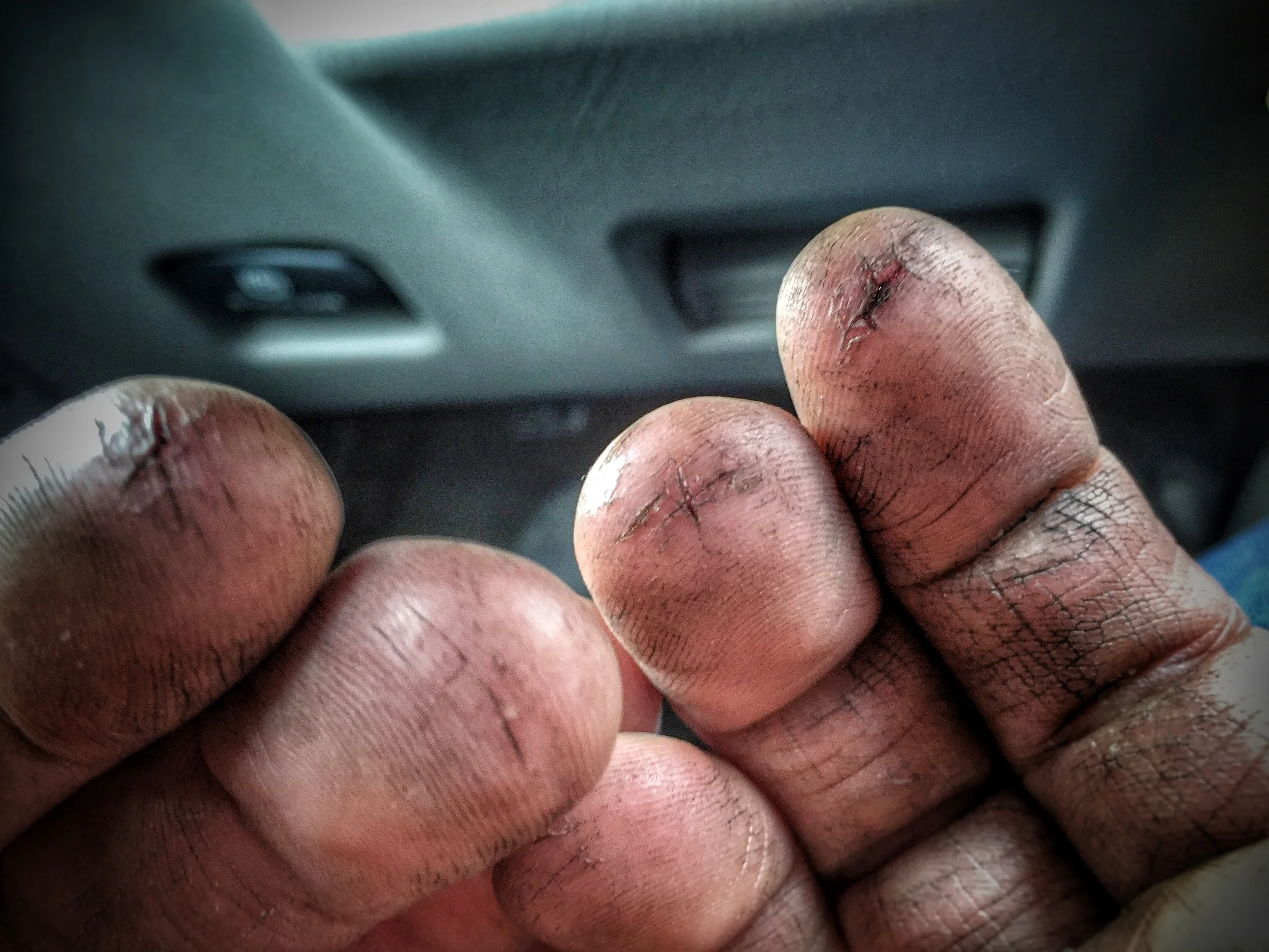 Fingers: Cracked and bleeding after a long and trying project in Maryland.